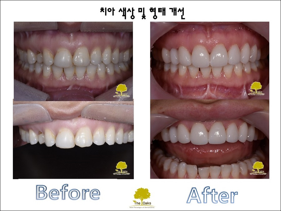 강남라미네이트가격 더 예뻐질 나를 위해 관련 이미지 1