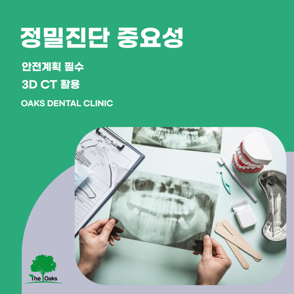 삼성동치과 임플란트수술 과정과 회복까지 제대로 이해해야 하는 이유 관련 이미지 2