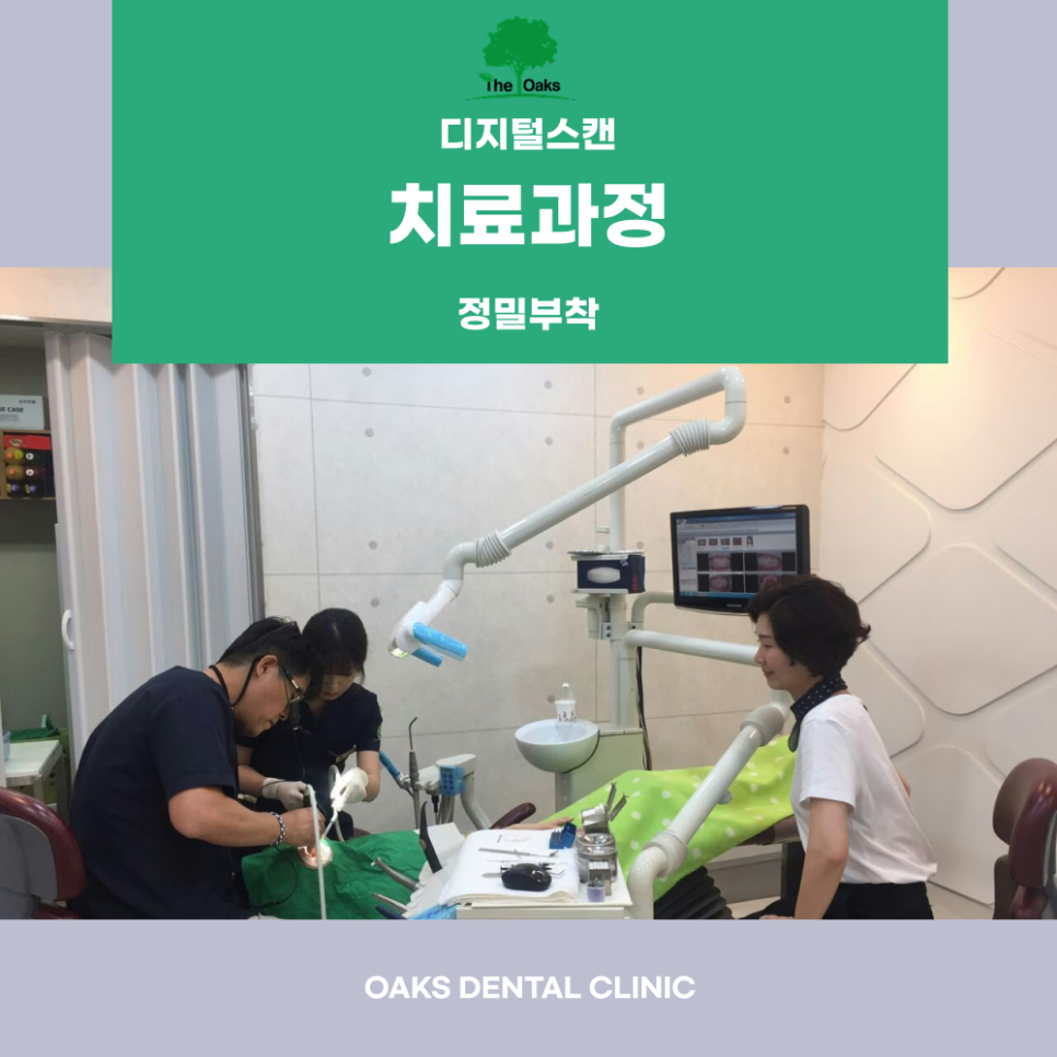 강남역 원데이 라미네이트 빠른 변화로 미소를 완성하는 방법 관련 이미지 3