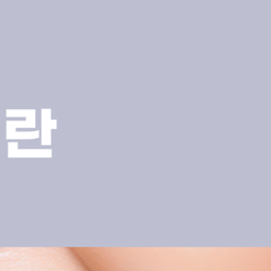 강남역치과 앞니크라운 자연스러운 미소를 위한 심미 보철 치료 관련 이미지 10