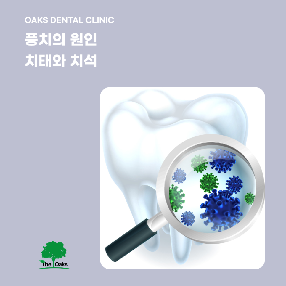 자곡동치과 풍치치료 잇몸이 보내는 신호를 살펴보세요 관련 이미지 1