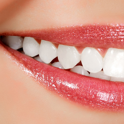 압구정동치과 치아교정 단순한 미용이 아닌 삶의 균형을 되찾는 과정 관련 이미지 11