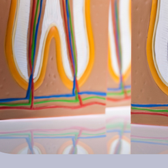 Samseong-dong Dental Clinic: Problems Caused by Ignoring Periodontitis and How to Manage It image 15