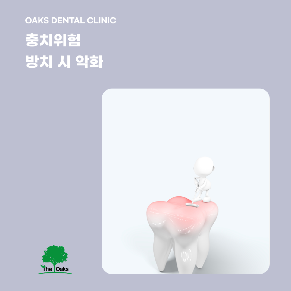 강남역 원데이 충치치료 바쁘신 분들을 위한 빠르고 정확한 해결 방법 관련 이미지 1