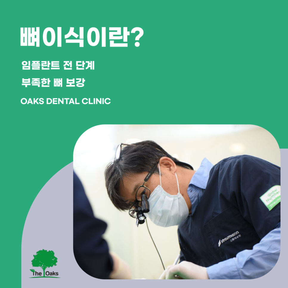 삼성동치과 뼈이식임플란트 뼈가 부족해도 가능한 이유 관련 이미지 1