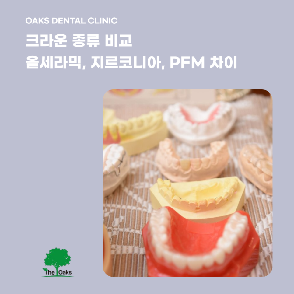 자곡동치과 앞니크라운 치료가 필요할 때는 언제일까 관련 이미지 3