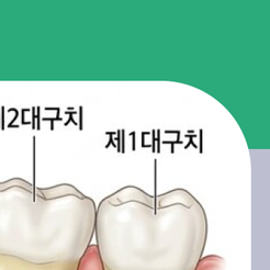 청담동치과 매복사랑니는 왜 발치할까요? 관련 이미지 13