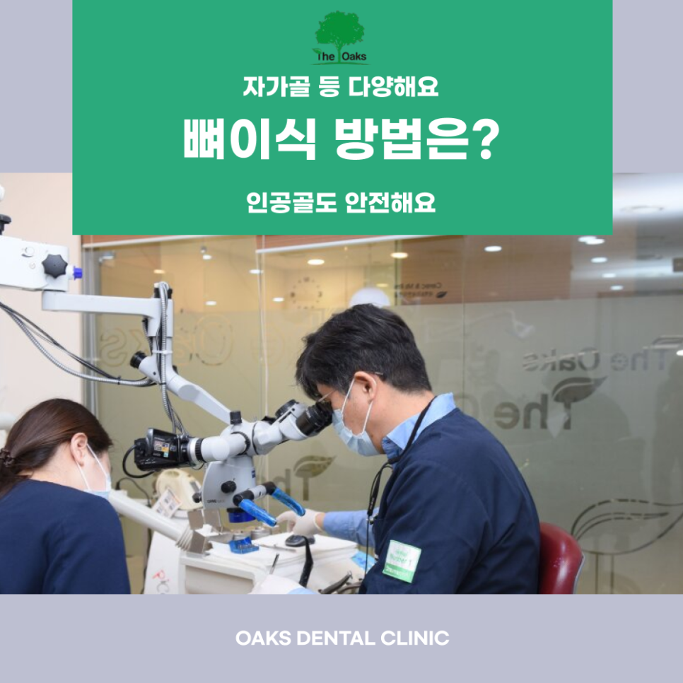 삼성동치과 임플란트뼈이식 꼭 필요한 이유 관련 이미지 3