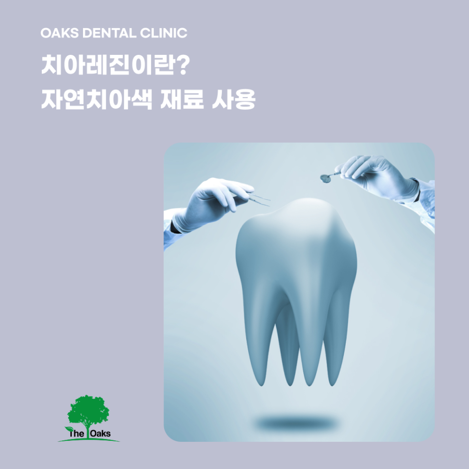 신사동치과 치아레진 자연스러움과 보존을 동시에 잡는 치료 관련 이미지 1