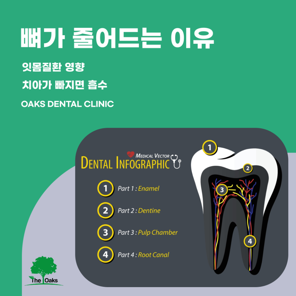 강남치과 뼈이식임플란트 꼭 필요한 경우는? 관련 이미지 2