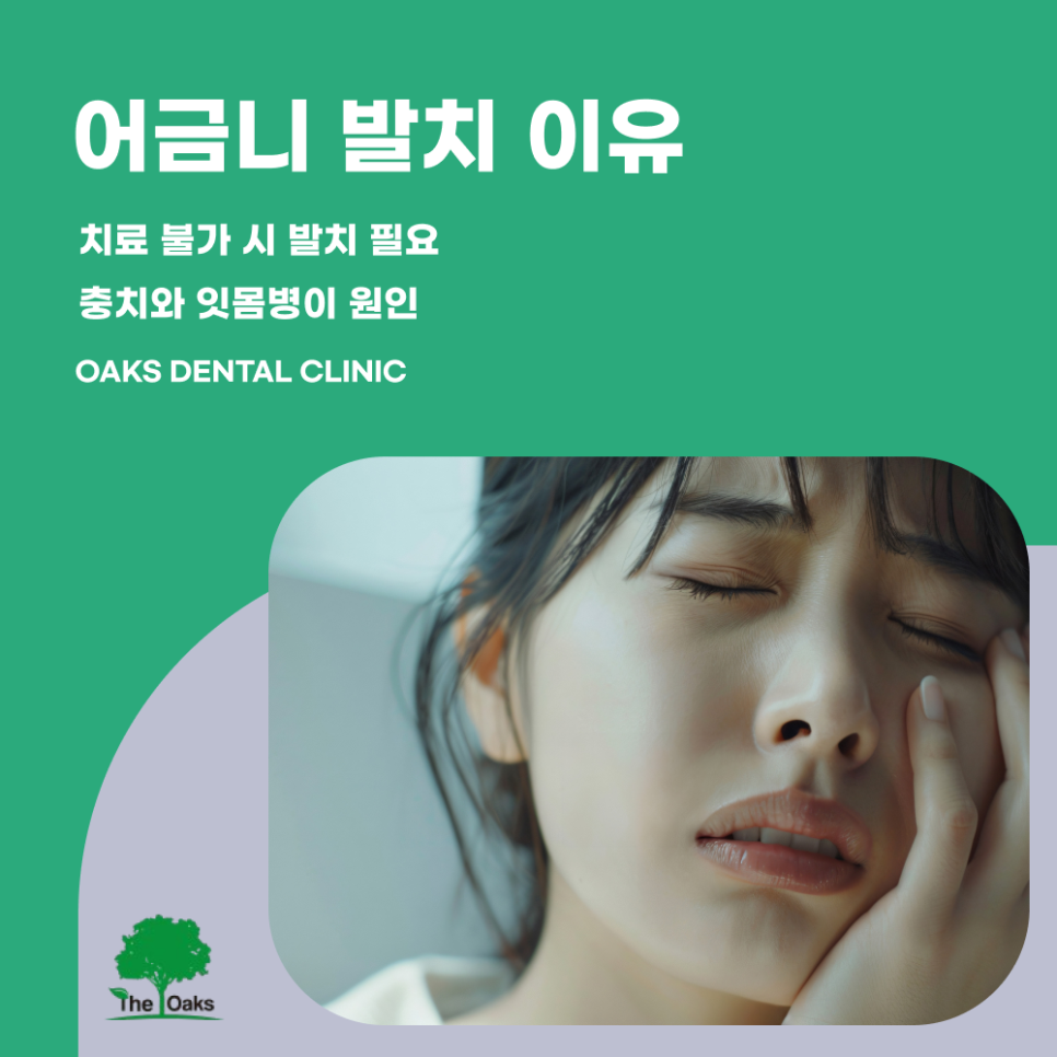 도곡동치과 어금니발치 꼭해야할까 관련 이미지 1