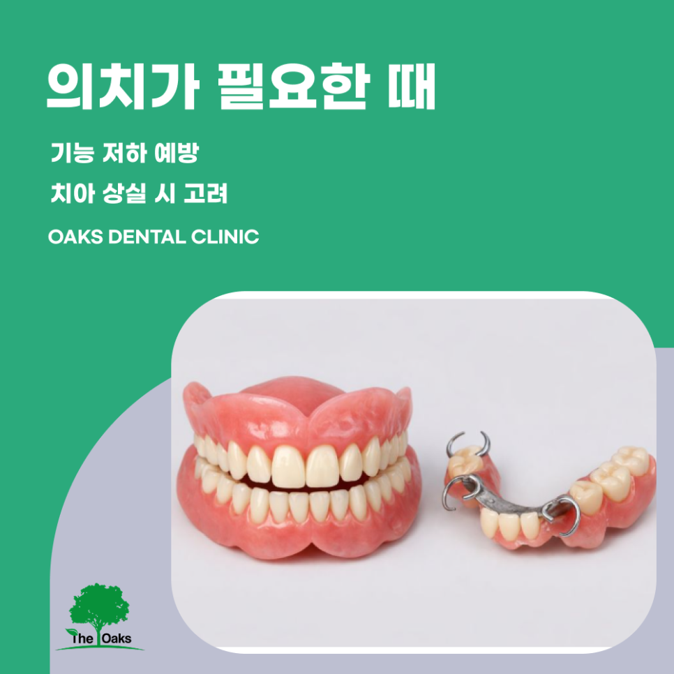 세곡동치과 의치 잃어버린 치아 기능을 다시 되찾는 방법 관련 이미지 1