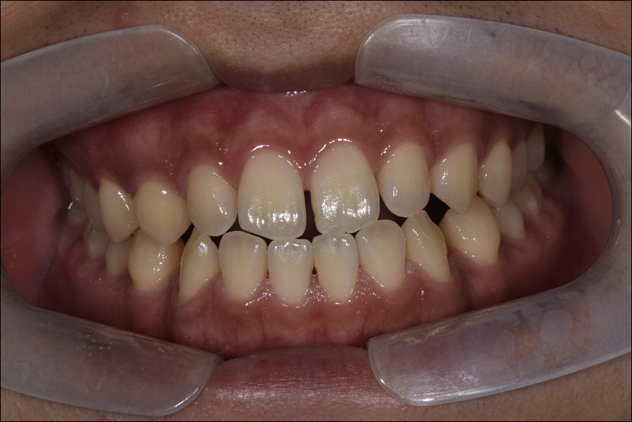 신논현치과 치아 건강을 위하여 관련 이미지 1