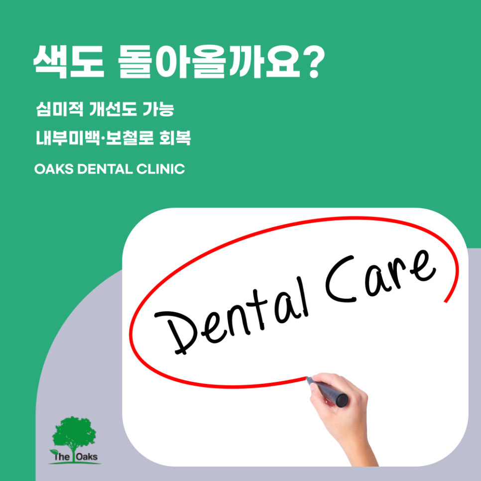 세곡동치과 앞니신경치료 꼭 필요한 이유와 치료 과정 안내 관련 이미지 4