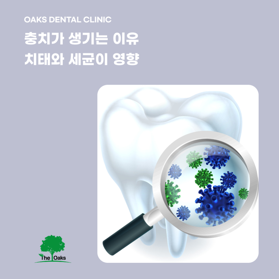 강남역치과 충치치료 미루지 말고 확인해야 하는 이유 관련 이미지 1