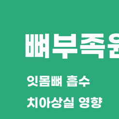 세곡동치과 뼈이식임플란트 부족한 잇몸뼈를 보완해 성공률을 높이는 방법 관련 이미지 8