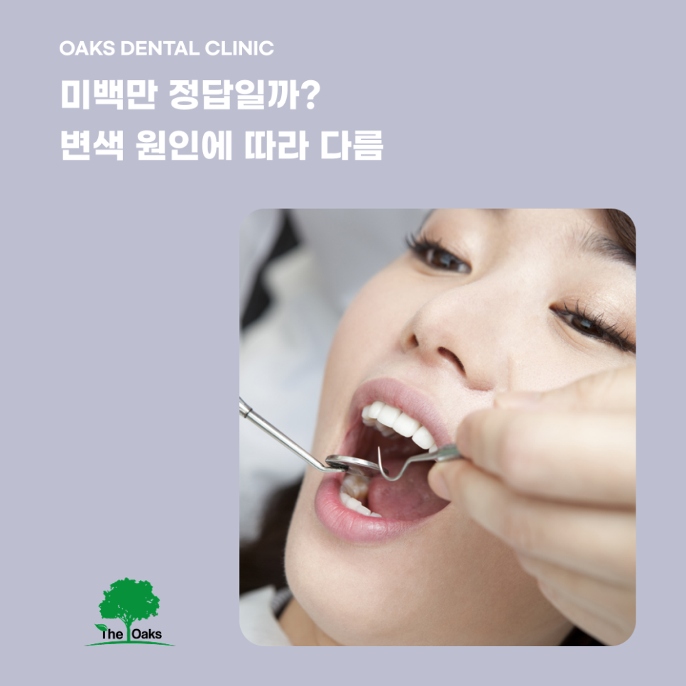 Daechi-dong Dental Clinic: Teeth Whitening Effects and Process, Helpful Information to Know Before Treatment image 5