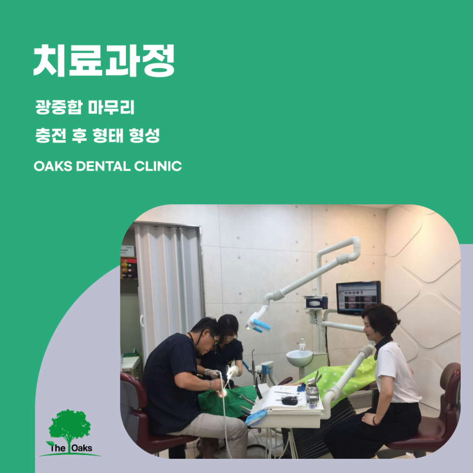 서초역치과 치아레진 자연스럽게 복원하는 방법 장점과 주의사항까지 관련 이미지 3