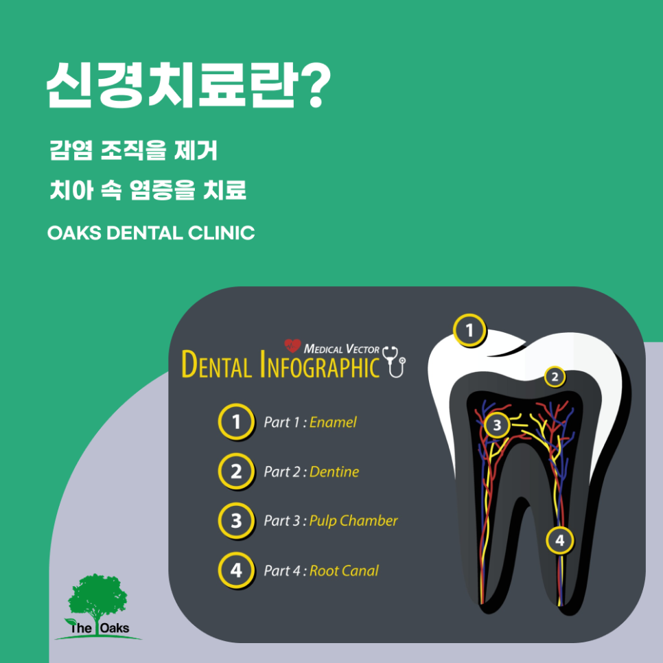 서초역치과 신경치료 전 알아두면 좋은 것들 관련 이미지 1