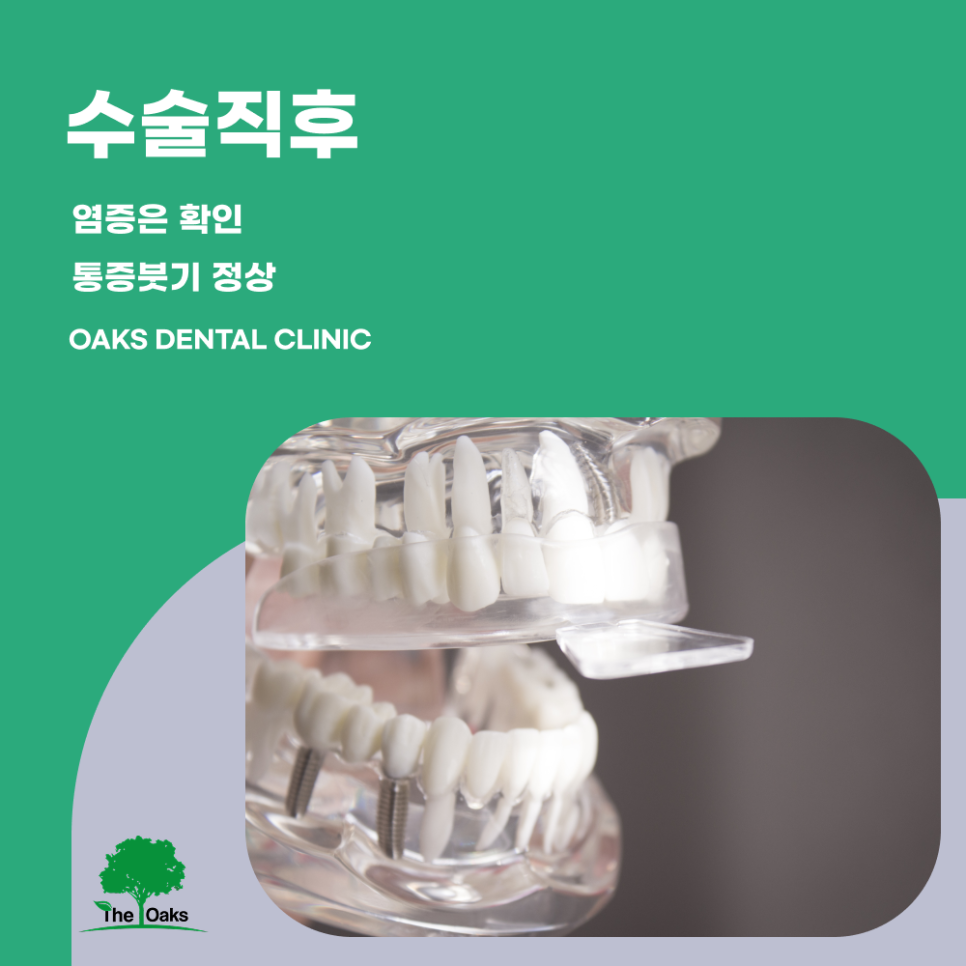 신사동치과 임플란트부작용 미리 알수록 예방할 수 있습니다 관련 이미지 2