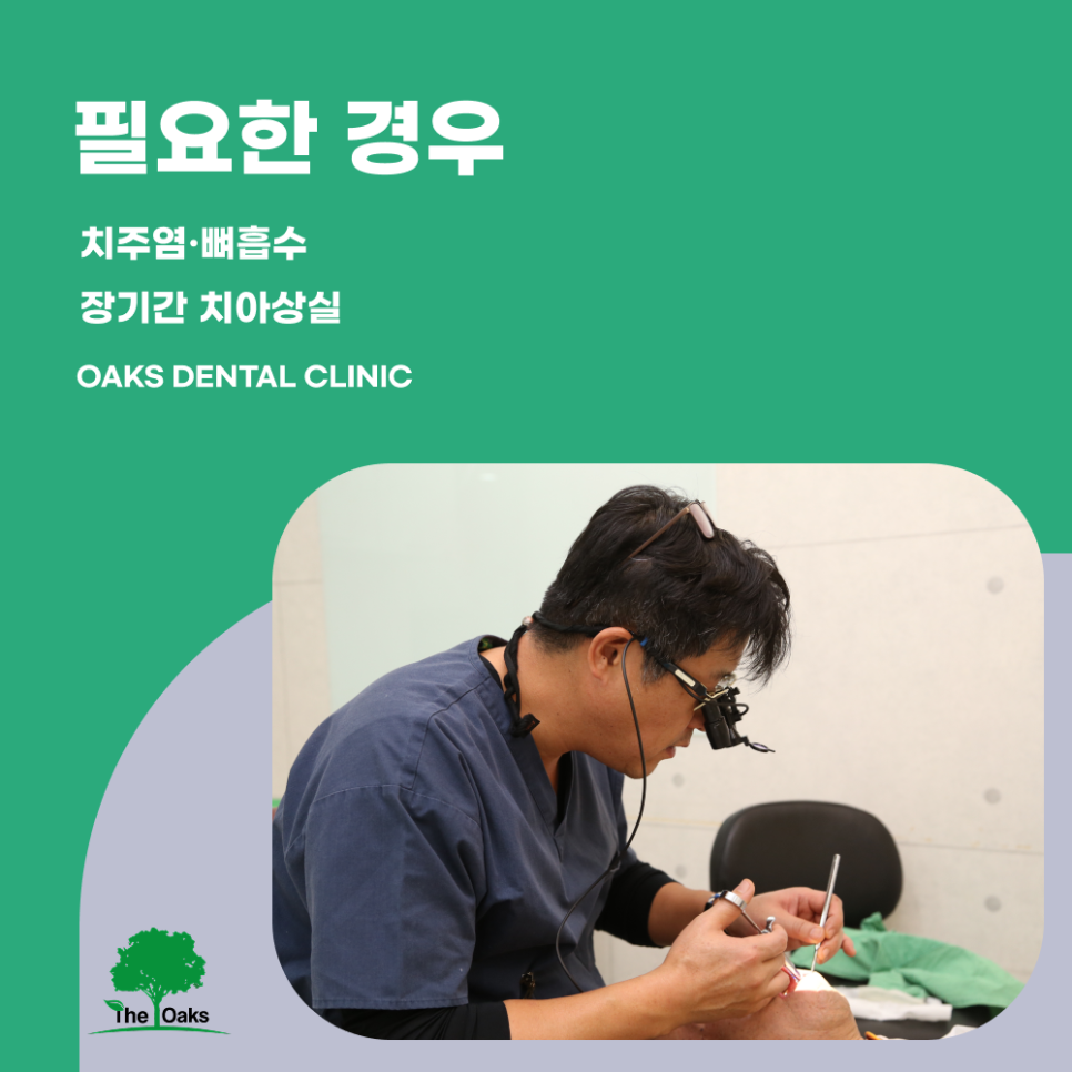 역삼동치과 임플란트뼈이식, 성공적인 임플란트를 위한 필수 과정 관련 이미지 2