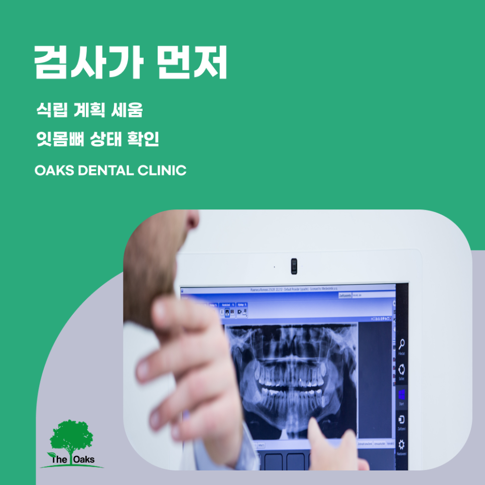 강남치과 뼈이식임플란트 꼭 필요한 경우는? 관련 이미지 3