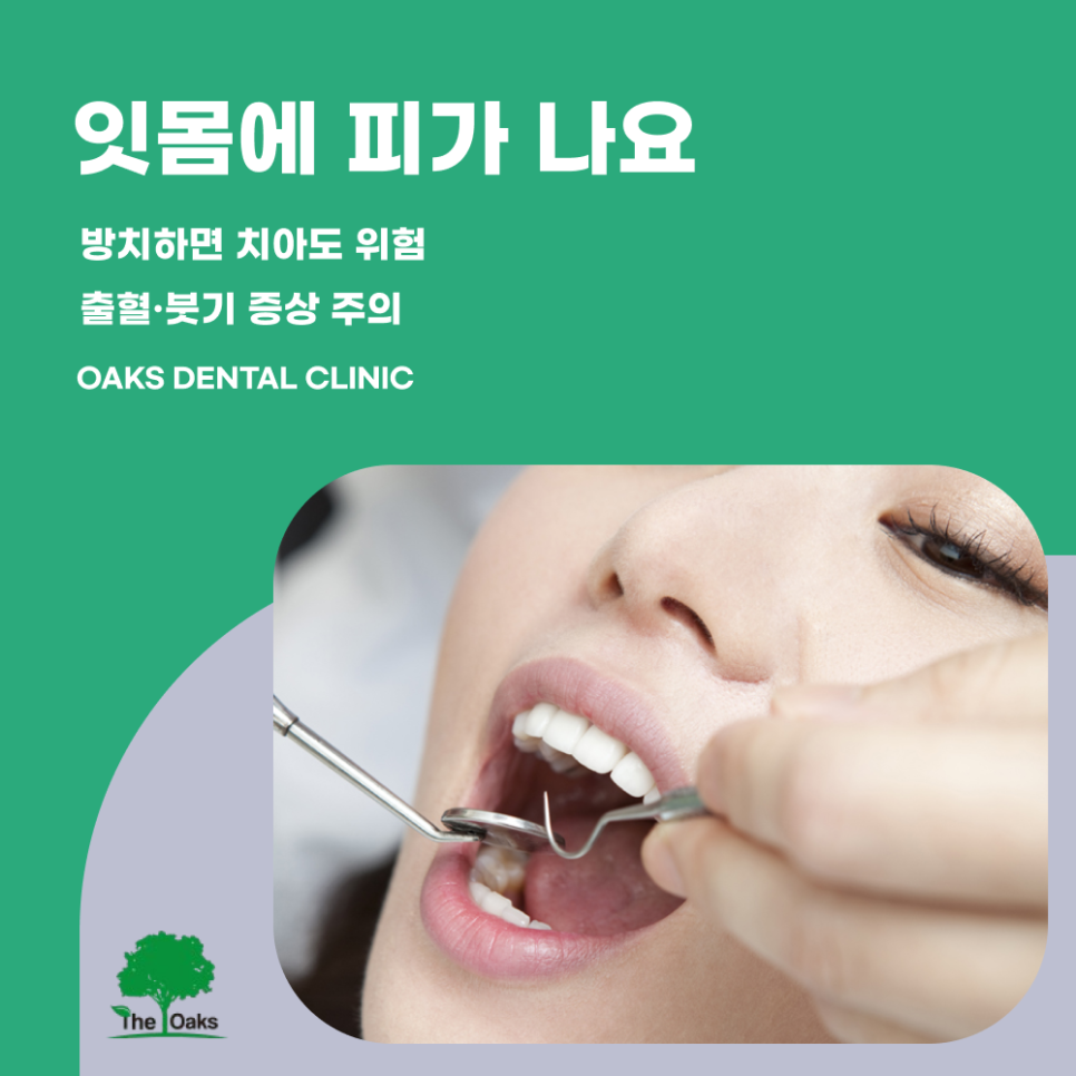 강남치과 잇몸치료 완전 정리 관련 이미지 3