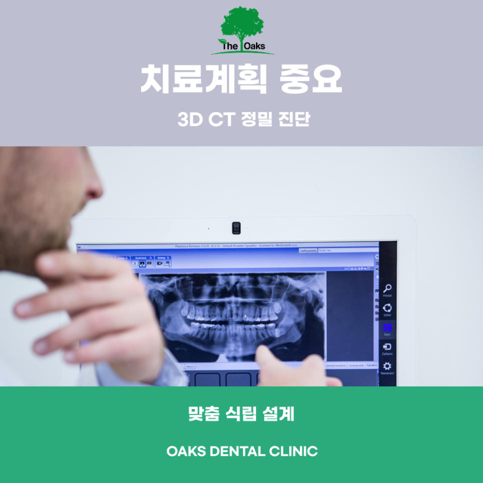 논현동치과 전체임플란트 여러 치아를 동시에 회복하는 체계적인 치료 관련 이미지 3
