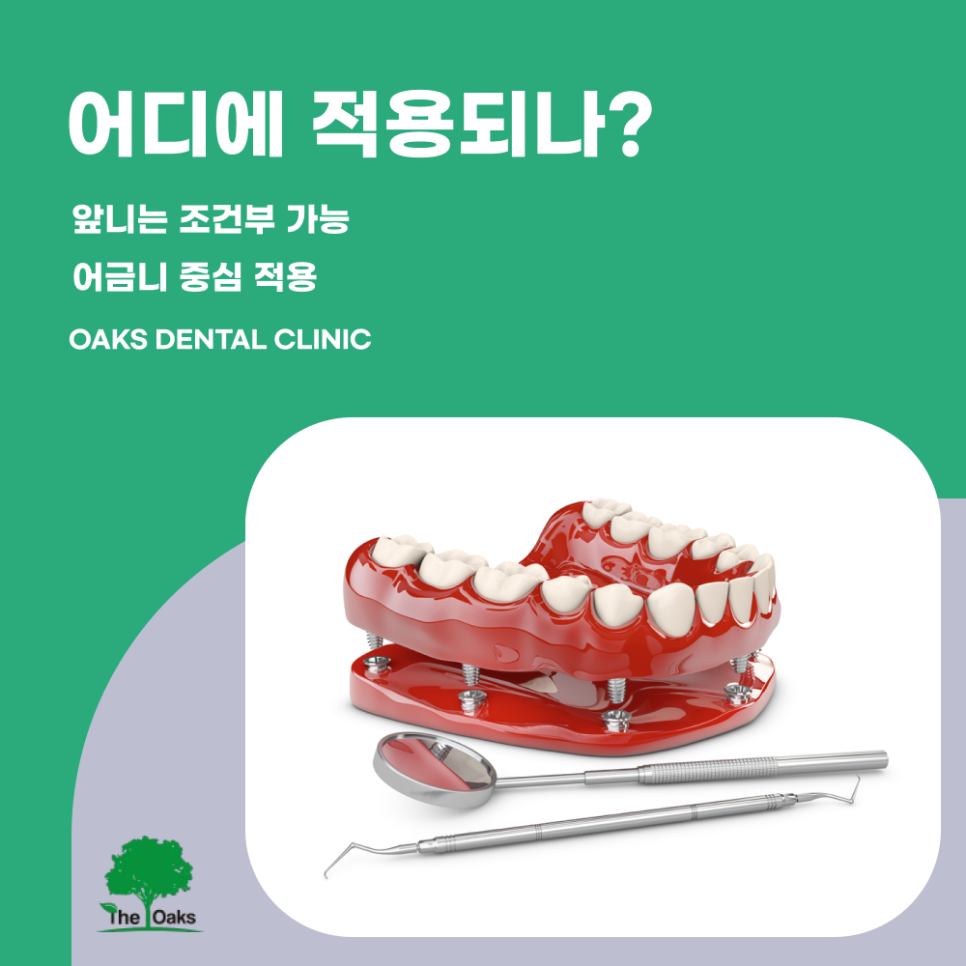 압구정동치과 건강보험임플란트 65세 이상이라면 꼭 확인하세요 관련 이미지 3