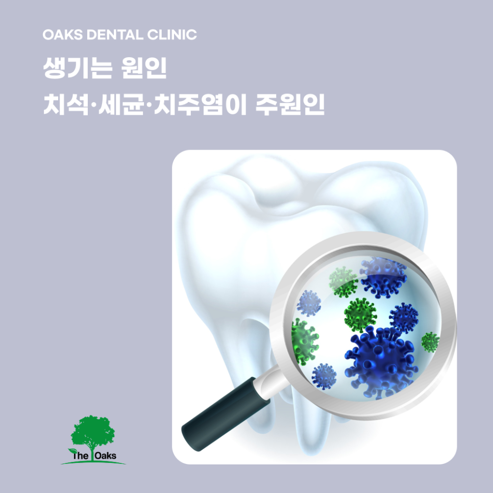 청담동치과 잇몸고름주머니 방치하면 치아까지 위험할 수 있어요 관련 이미지 2