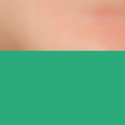 압구정동치과 치아교정 단순한 미용이 아닌 삶의 균형을 되찾는 과정 관련 이미지 14