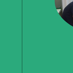 도곡동치과 임플란트기간 얼마나 걸릴까 단계별 과정부터 회복까지 안내 관련 이미지 11