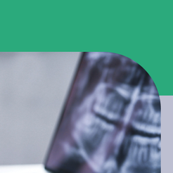 자곡동치과 치통 원인부터 해결까지 통증을 가볍게 넘기면 안 되는 이유 관련 이미지 13