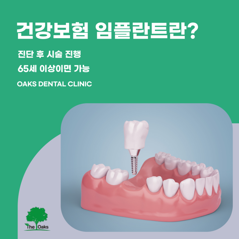 압구정동치과 건강보험임플란트 65세 이상이라면 꼭 확인하세요 관련 이미지 1