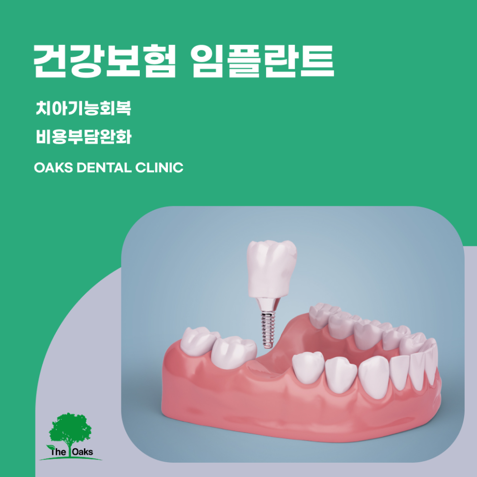 삼성동치과 건강보험임플란트 부담을 줄이며 치아 기능을 회복하는 방법 관련 이미지 1