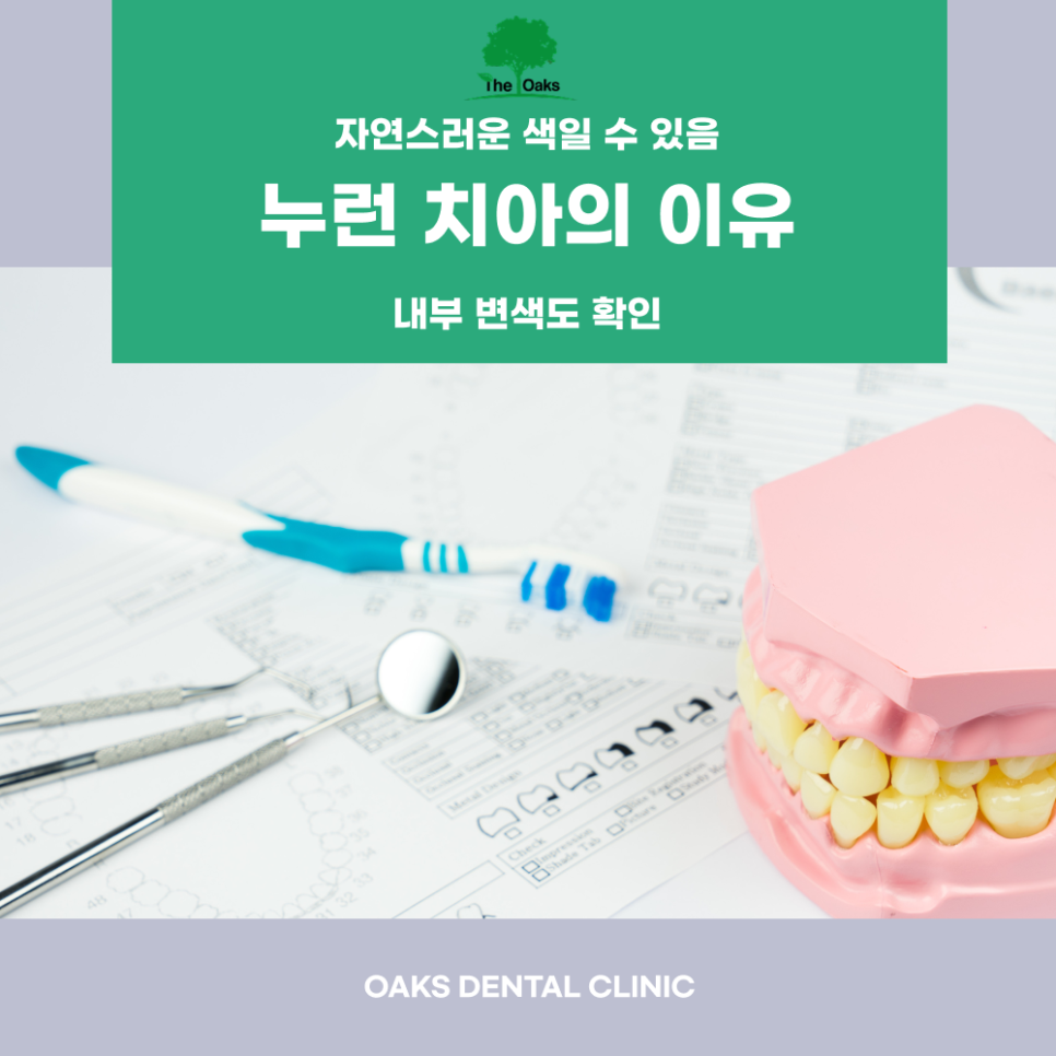 역삼동치과 치아착색 예방을 위한 평소 관리 방법 관련 이미지 3