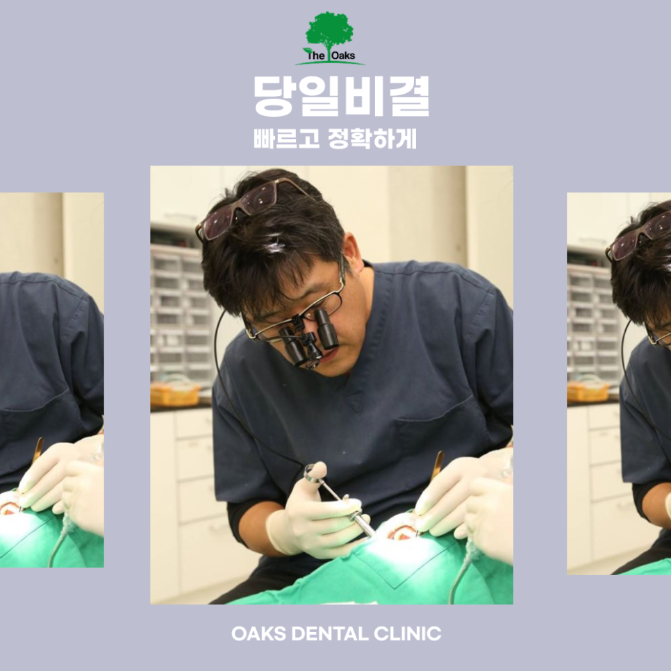 Who Is a Same-Day Laminate Procedure in Gangnam Suitable For? Essential Information to Know Before Treatment image 3