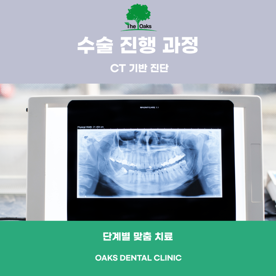 압구정동치과 치주수술로 잇몸 염증을 개선하고 치아를 오래 지키는 방법 관련 이미지 4