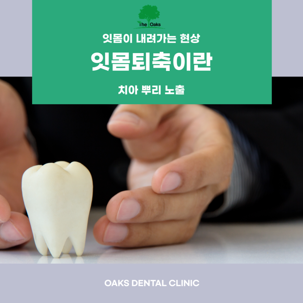 강남치과 잇몸퇴축 잇몸 건강이 보내는 경고 신호 관련 이미지 1