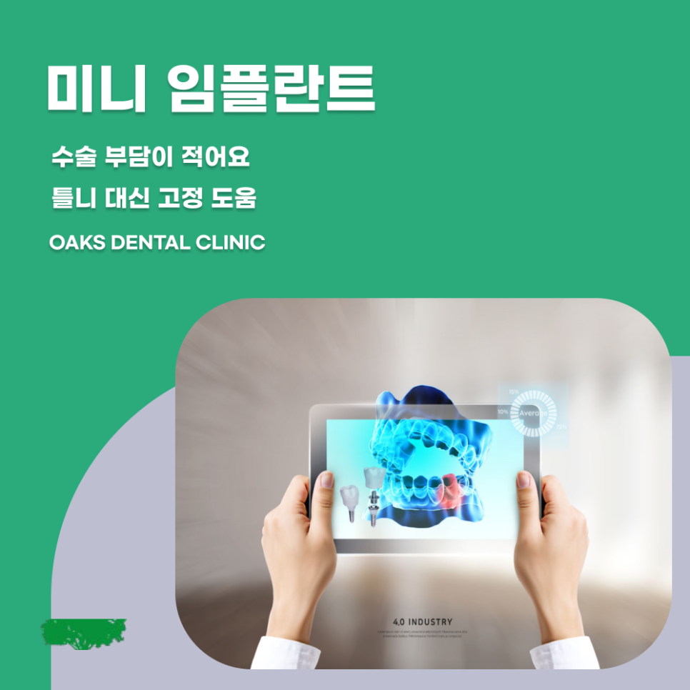 압구정동치과 임플란트종류 나에게 맞는 치료는 무엇일까 관련 이미지 4