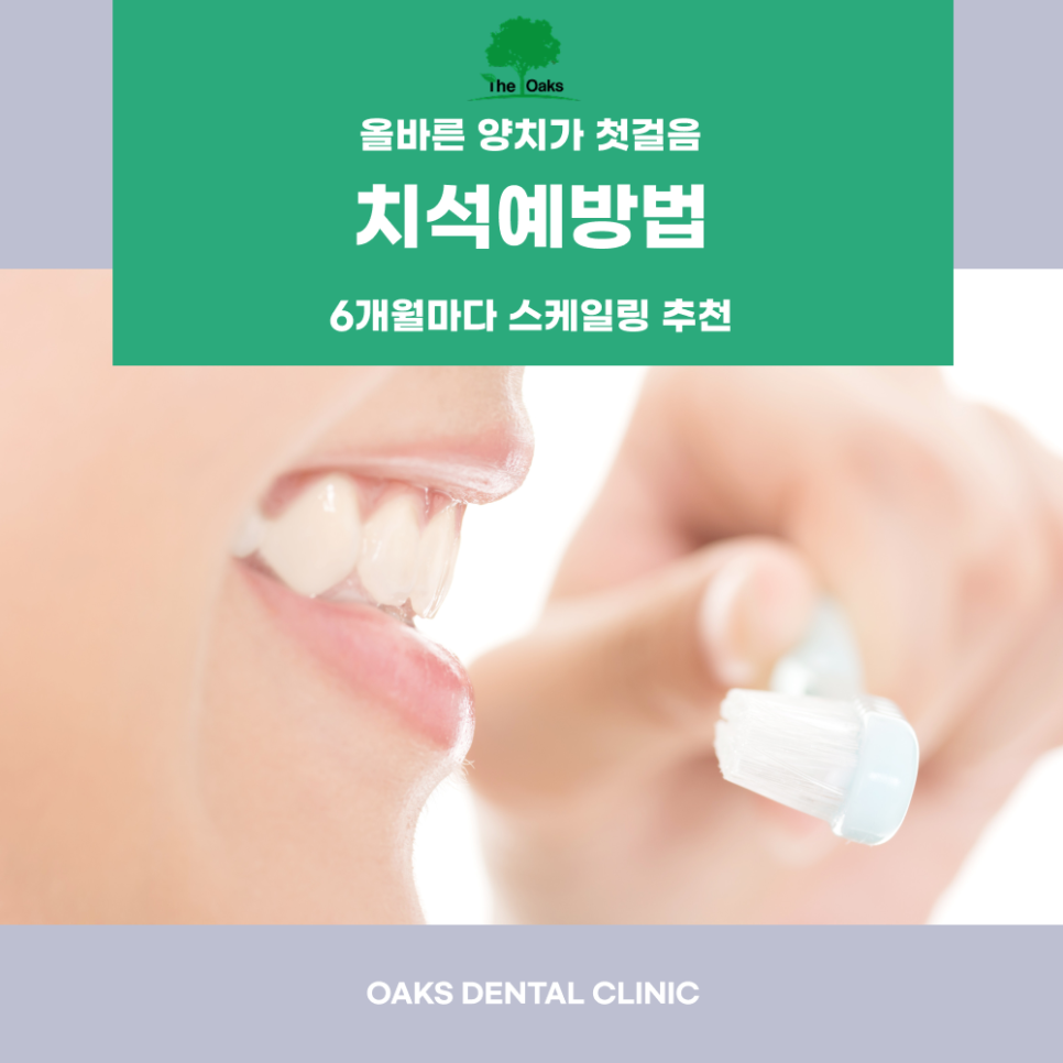 도곡동치과 치석제거 건강한 잇몸의 시작입니다 관련 이미지 5