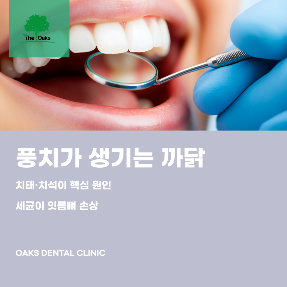강남역치과 풍치치료로 잇몸을 지키는 법 관련 이미지 1