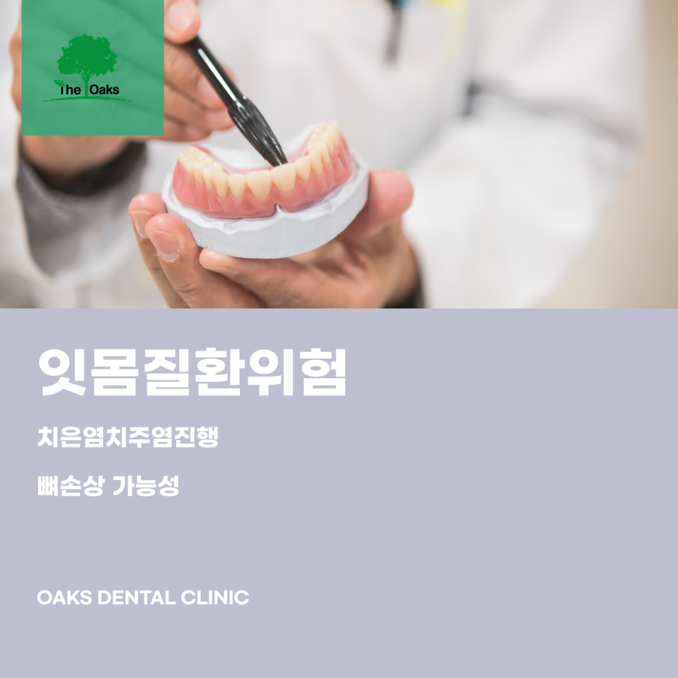 서초역치과 치석제거 왜 정기적인 스케일링이 치아를 지키는 첫걸음일까요 관련 이미지 2