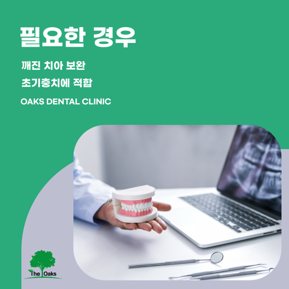 서초역치과 치아레진 자연스럽게 복원하는 방법 장점과 주의사항까지 관련 이미지 2