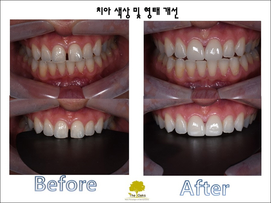 강남라미네이트 최소한의 삭제 관련 이미지 1