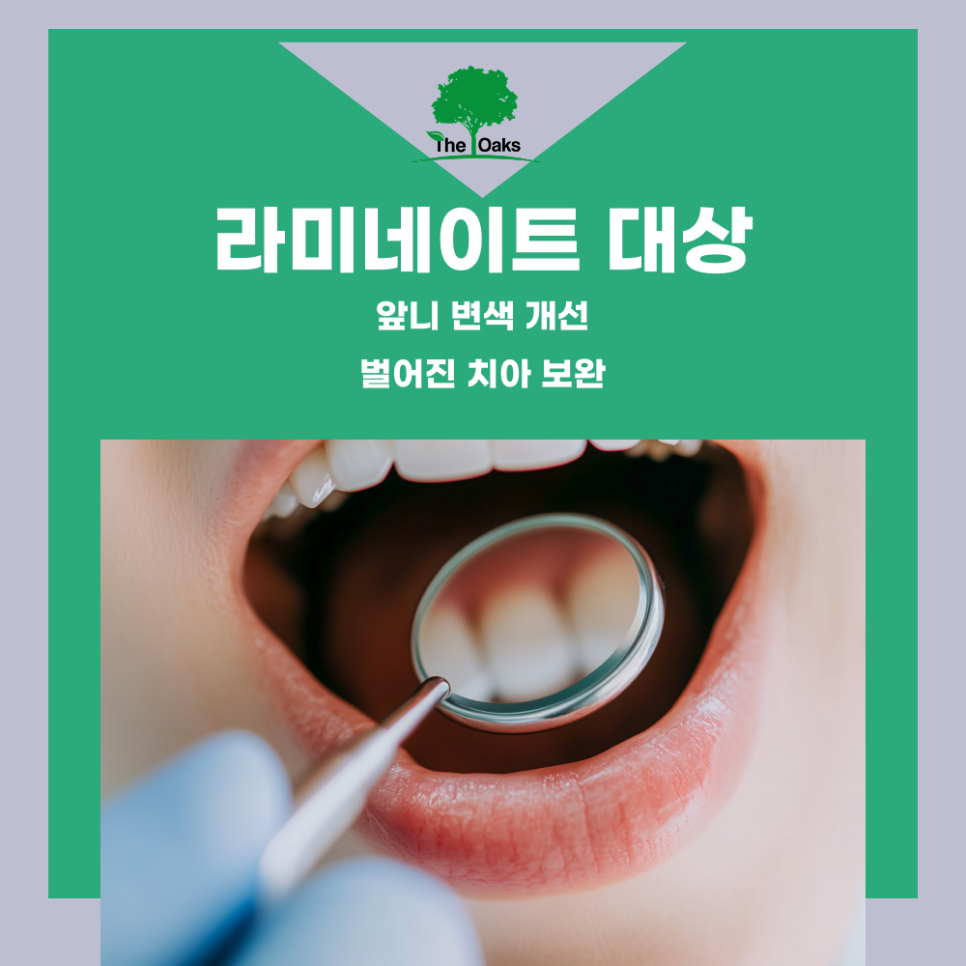 대치동치과 라미네이트 자연스럽게 하고 싶다면 심미치료 전 꼭 알아야 할 핵심 정보 관련 이미지 2