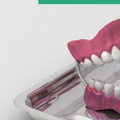 세곡동치과 의치 잃어버린 치아 기능을 다시 되찾는 방법 관련 이미지 11