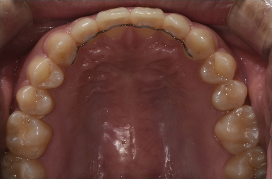 신논현치과 치아 건강을 위하여 관련 이미지 6