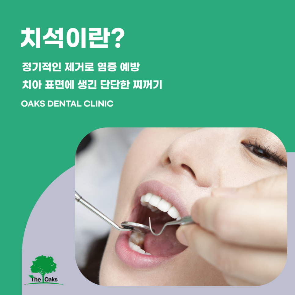 도곡동치과 치석제거 건강한 잇몸의 시작입니다 관련 이미지 1