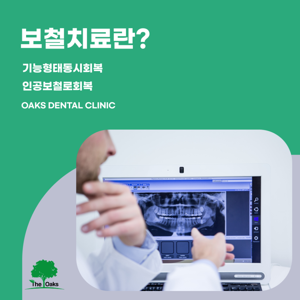 강남구치과 보철치료 손상된 치아를 기능과 심미까지 회복하는 방법 관련 이미지 1